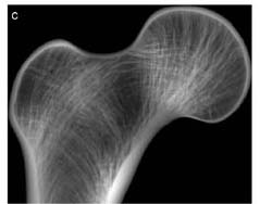 trabecular_bone_web